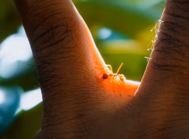 biting ants in vermont